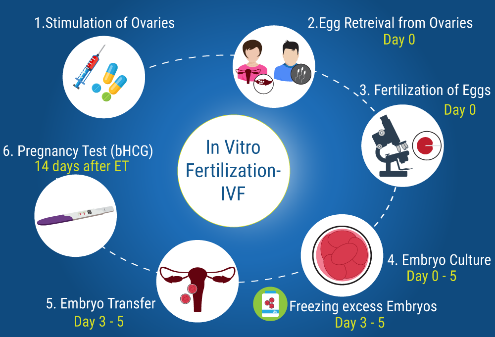 IVF treatment kyon kiya jaata hai